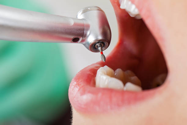 Best Emergency Treatment for Oral Infections in Center Moriches, NY